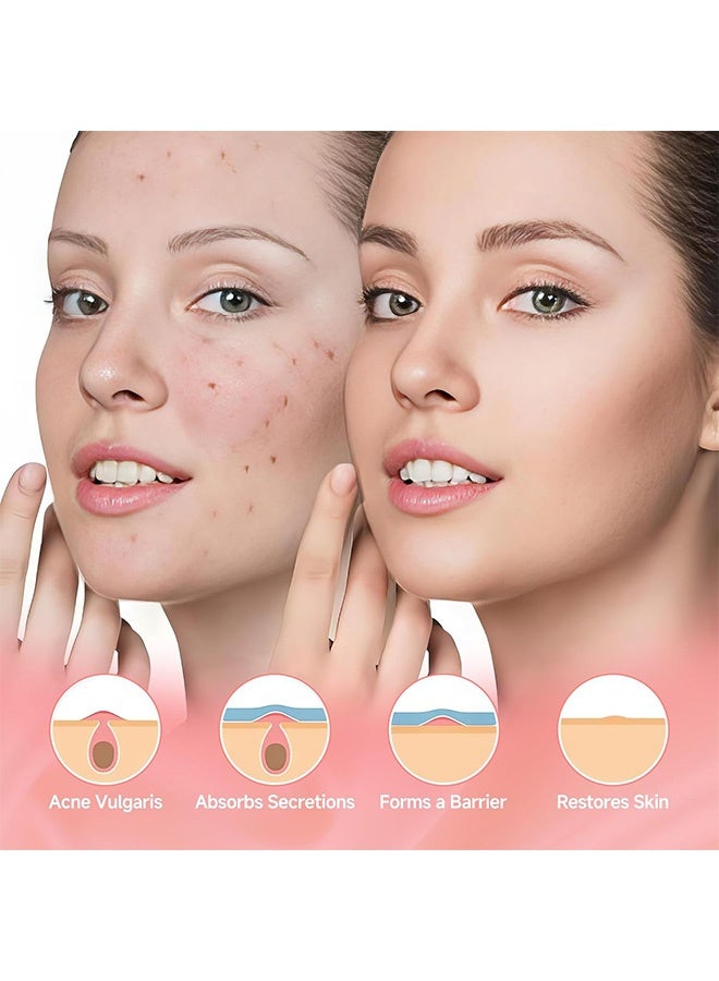 Acne patch 360 Count Pimple Patch Acne Covering Stickers For Face And Skin For Men And Women Daily Skin Care - Image 5