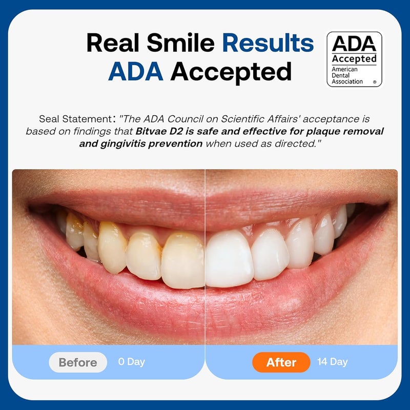 Bitvae D2 Electric Toothbrush with 8 Replacement Heads and Travel Case - ADA Accepted - Image 3