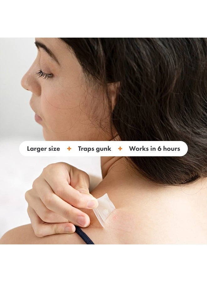 Mighty Patch سطح من هيرو كوزمتيكس - لاصقات حب الشباب الهيدروكولودية للبثور الكبيرة، لاصقات علاجية للجسم، الخد، الجبين، والذقن، نباتية وخالية من القسوة (10 قطع) - Image 3