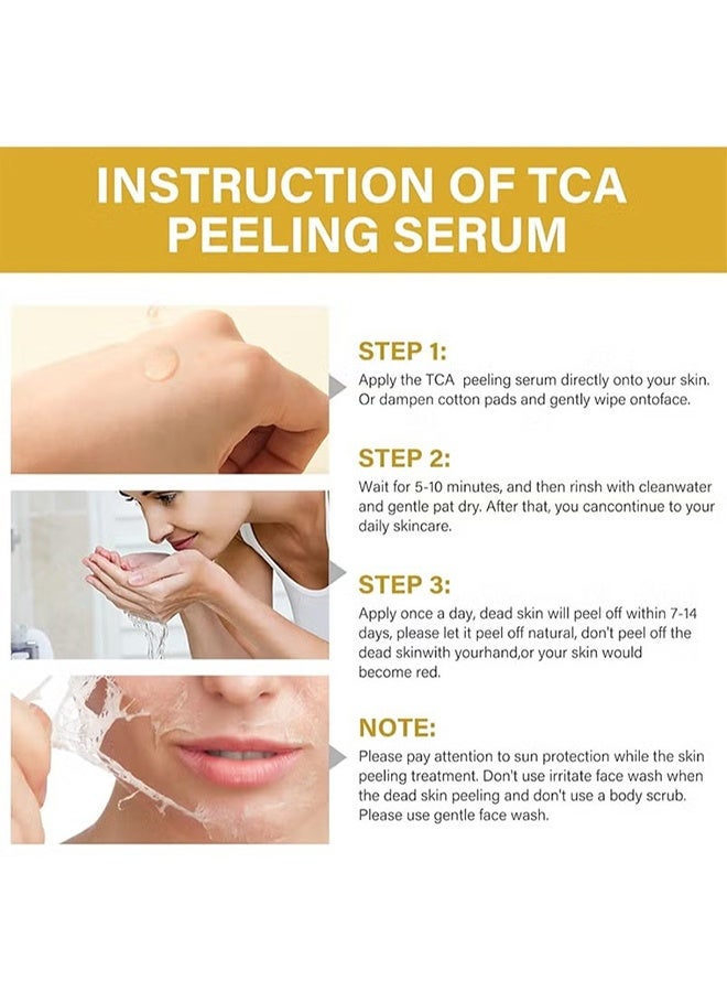 MOOYAM TCA 50% Peel Solution 30ml, with Malic Acid & Citric Acid Peeling Serum, Anti-Aging Reduce Acne and Dark Spots Even Skin Tone  - Image 4