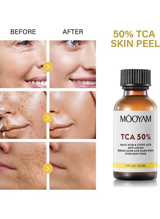 MOOYAM TCA 50% Peel Solution 30ml, with Malic Acid & Citric Acid Peeling Serum, Anti-Aging Reduce Acne and Dark Spots Even Skin Tone  - Image 3