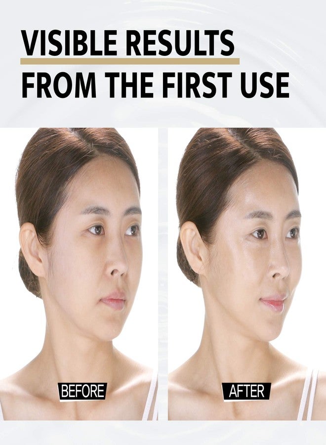 DOCTORCOS Silicone Skin Mask | Face Lifting Double Chin Reducer | V Line Lifting | Under Eye Mask | Forehead Wrinkles Treatment | Korean Skin Care - Image 5