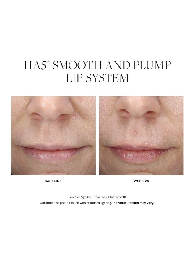 Skinmedica SkinMedica HA5 Smooth & Plump Lip System - Your Hydrating, Volumizing Lip Plumper for Visibly Fuller and Smoother Lips, 0.05 Oz  - Image 3
