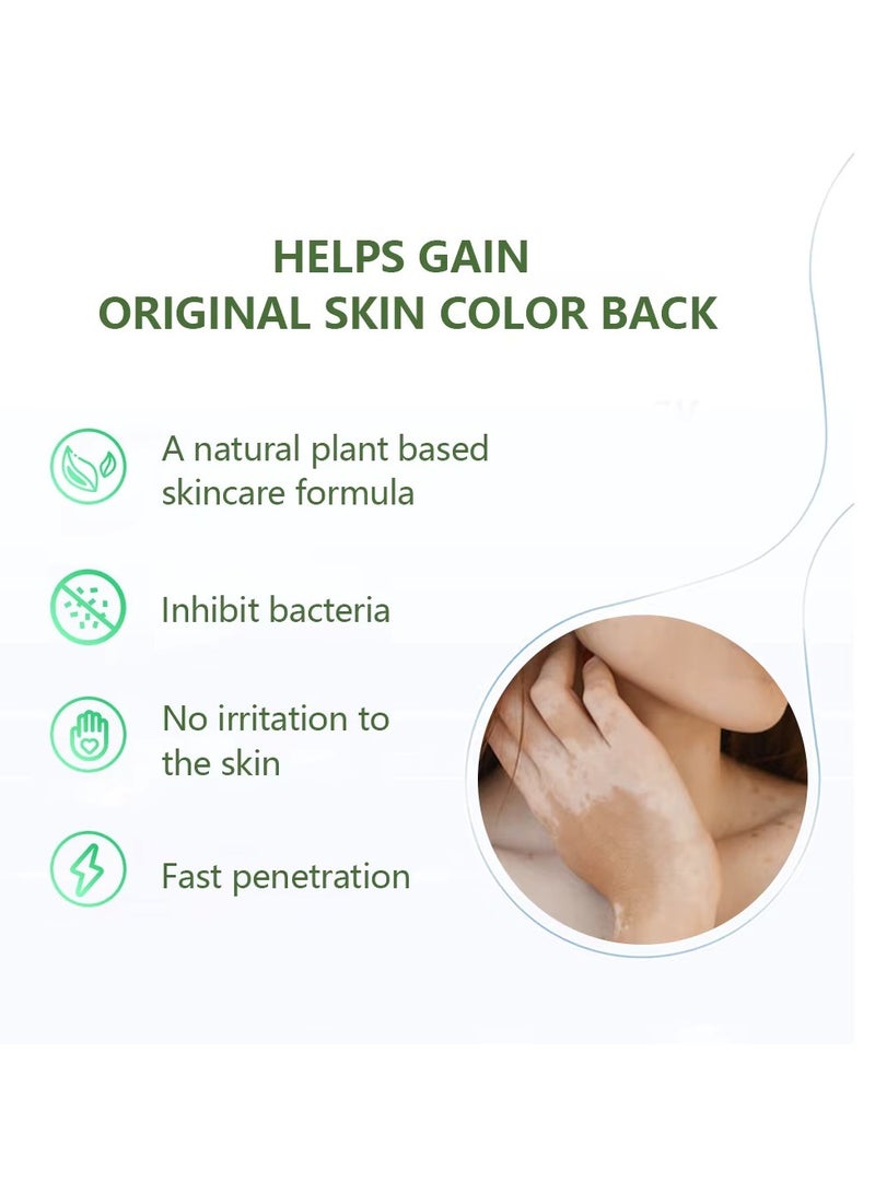 سوميفون صندوق كريم العناية بالبهاق من سومفون، 30 جرام، كريم إصلاح مكثف للبشرة لعلاج البهاق، والبقع البيضاء، ويعيد لون البشرة، مثالي للبقع البيضاء، والنمش، والبقع الشمسية، ويعزز تغذية البشرة وإصلاحها - Image 3