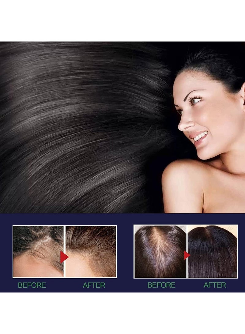 أوهو رذاذ نمو الشعر من Ouhoe، رذاذ إعادة نمو الشعر من Ouhoe للرجال والنساء، زيت نمو الشعر من Ouhoe، مصل تعزيز الشعر من Ouhoe، رذاذ زيت تكثيف نمو الشعر الطبيعي، أفضل منتج لنمو الشعر - Image 3