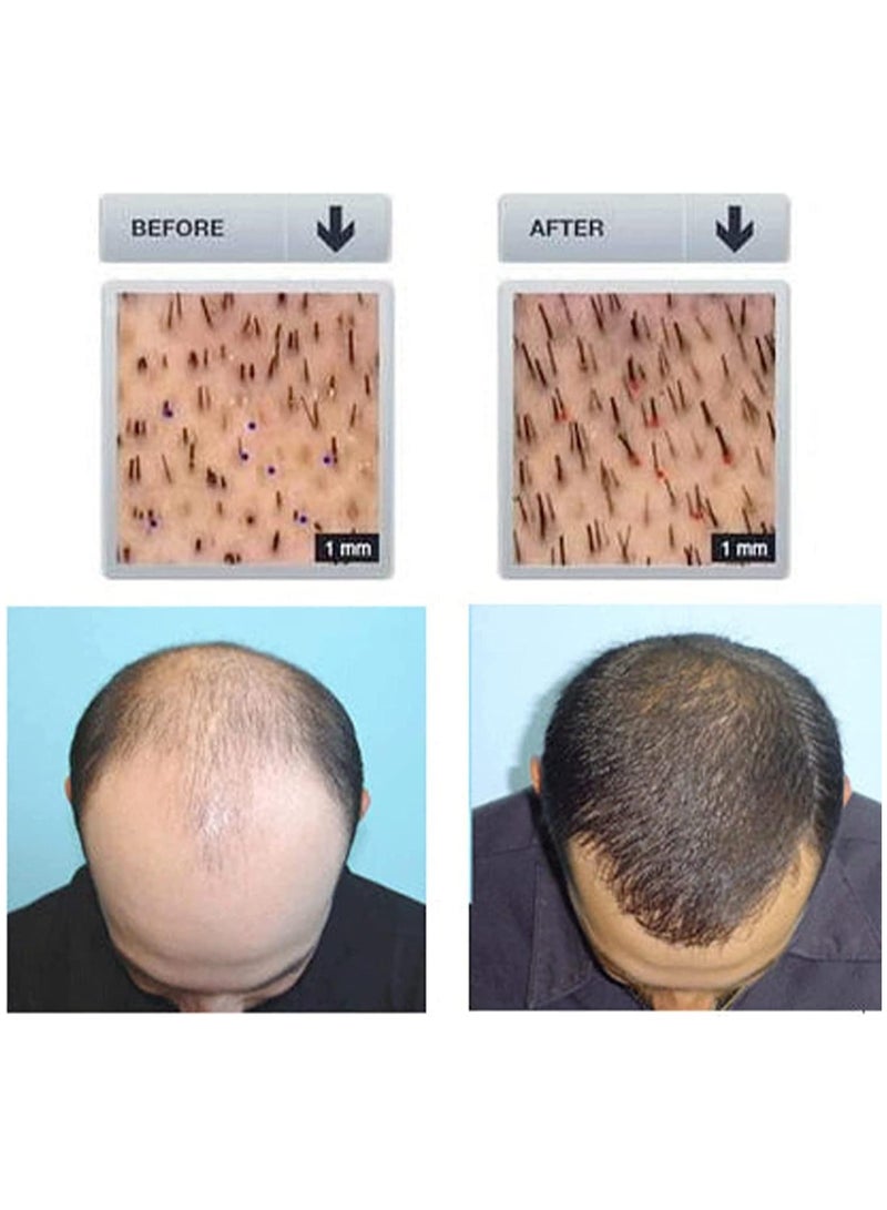 أوهو رذاذ نمو الشعر من Ouhoe، رذاذ إعادة نمو الشعر من Ouhoe للرجال والنساء، زيت نمو الشعر من Ouhoe، مصل تعزيز الشعر من Ouhoe، رذاذ زيت تكثيف نمو الشعر الطبيعي، أفضل منتج لنمو الشعر - Image 5