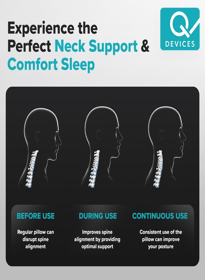 Q Devices Contour Neck Pillow: Orthopedic Cervical Support for Pain Relief, Ergonomic 2-Height Design for Side & Back Sleepers, Breathable & Durable Support for Spine & Shoulders - Image 3
