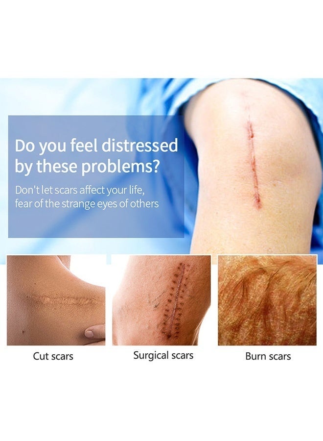ام اس ال اي ام جل علاج ندبات القرش ، كريم إزالة الندبات ، كريم إصلاح الندبات ، إزالة علامات تمدد الندبات ، تخفيف وإصلاح علامات حب الشباب (20 جم) - Image 5