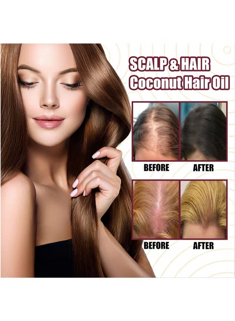 OUHOE Premium Red Onion Hair Oil，Onion Thickening Spray，Hair Oil with Onion Extract Onion Hair Growth Products for Men and Women Rapid Growth Anti-Hair Loss - Image 5