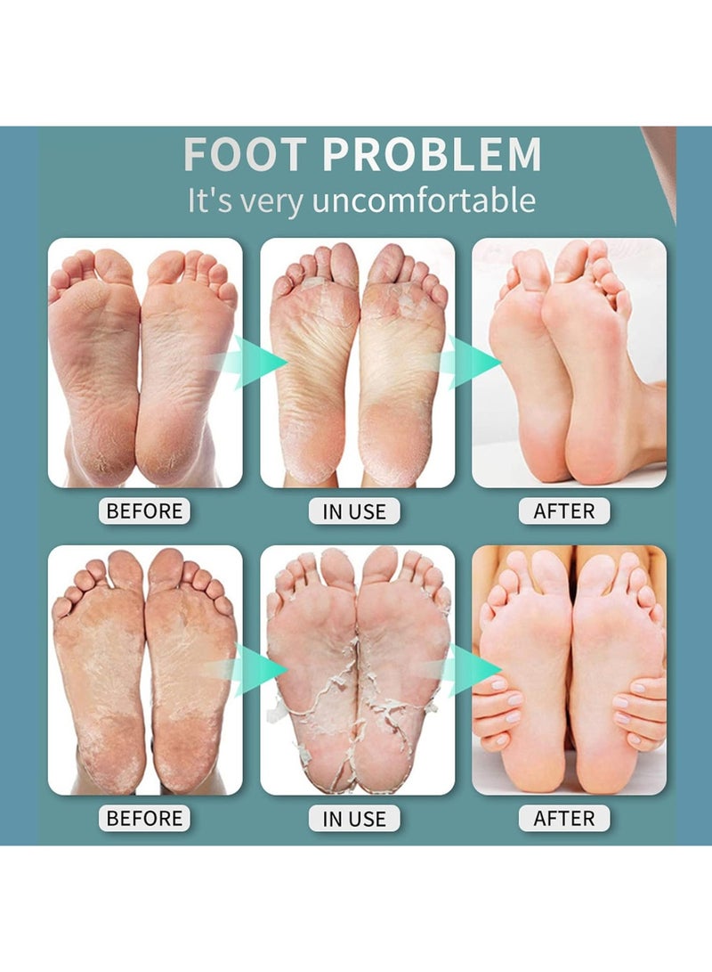 DubaiGallery Foot Odor Spray Shoe Sock Deodorant Spray Care Antiperspirant Feet Serum Anti-itch Spray Feet Care Liquid 30ml - Image 3