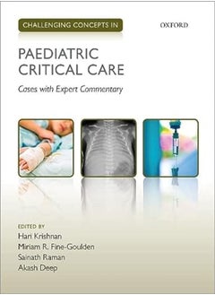 Challenging Concepts In Paediatric Critical Care Cases With Expert Commentary by Krishnan, Hari (Consultant Paediatric Intensivist, Consultant Paediatric Intensivist, Birmingham Chi Paperback 