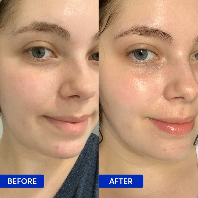 Sand & Sky Tasmanian Spring Water Deep Hydration Night Cream with 3x Hyaluronic Acid - Anti-Aging Repair Cream for Wrinkles, Boosts Collagen Production - Image 4