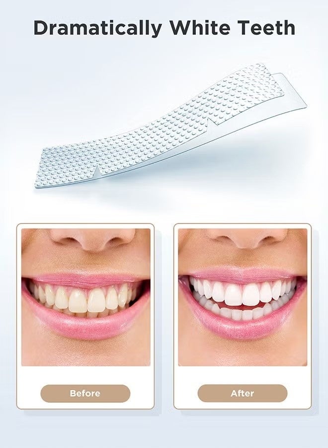 IVISMILE 28 Pcs 5D Teeth Whitening Kit, Teeth Whitening Strips for Sensitive, Professional Effects, 28 Strips Whitener Safe Whitestrip, Deep Stains Removal Tooth Whitening - Image 3