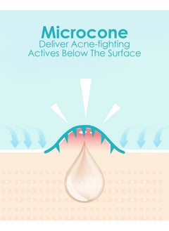 +1HEROLABS +1HEROLABS Microdart Acne Patch (18 Patches) - Hyaluronate, Salicylic Acid, Vitamin C, Microdart Pimple Patch for Deep, Early Stage and Hidden Pimples (18 Count (Pack of 1))  - Image 4