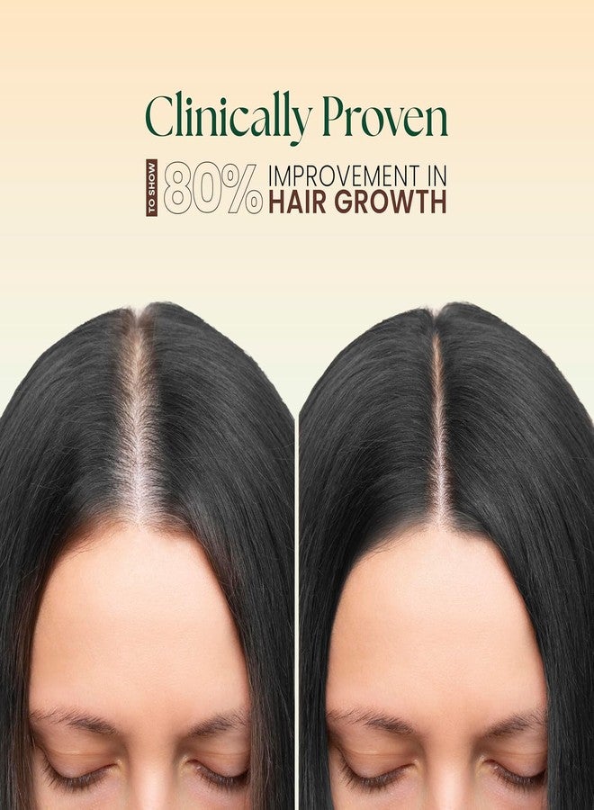 موها: زيت موها الأيورفيدي للشعر 5 في 1 لنمو الشعر والتحكم في تساقطه، مثبت سريريًا للحد من قشرة الرأس، 100 مل (عبوة من قطعتين) - Image 3