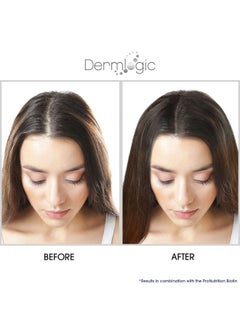 Dermlogic Hair Growth Serumextra Strength Dht Blocker Stimulates & Repairs New Follicle Regrowth. Grow Stronger Thicker Fuller Longer Healthier Hair. For Men & Women With No Side Effects.  - Image 5
