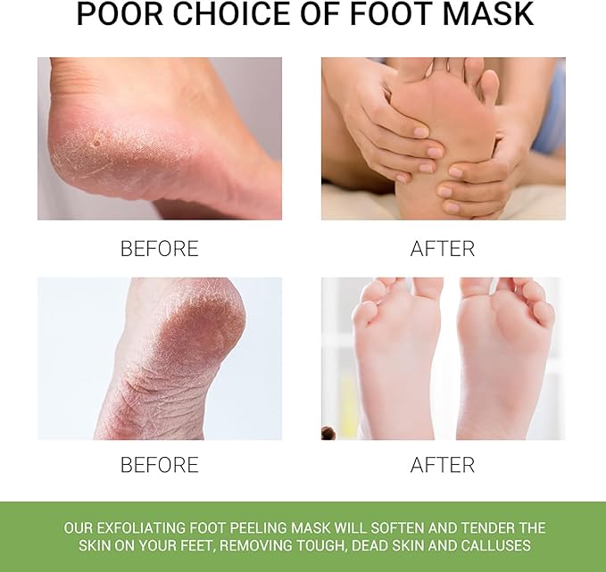 Joyeee Joyeee 3 Pairs Foot Peel Mask Repair Cracked Heels Remove Dry Dead Skin for Soft Baby Foot Effect Callus Remover Foot Exfoliating Socks for Hard Skin Foot Treatment for Men and Women Aloe Vera 