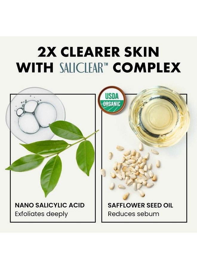 Eclat Skincare - Acne Spot Treatment Acne Cream Pimple Cream Spot Treatment For Face Pimple Cream Spot Treatment Acne Cream For Face Spot Acne Treatment - Image 1