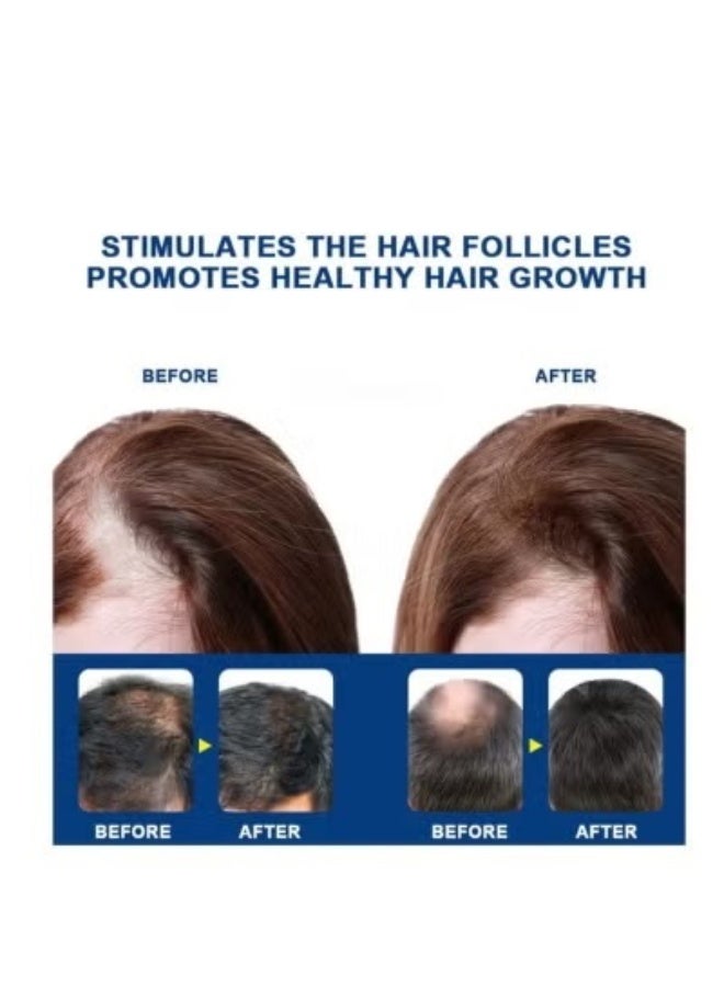 Sumifun Alopecia Hair Growth Cream for Promote Men's Hair Growth, Prevent Hair Loss, Care for Hair, 20g - Image 5