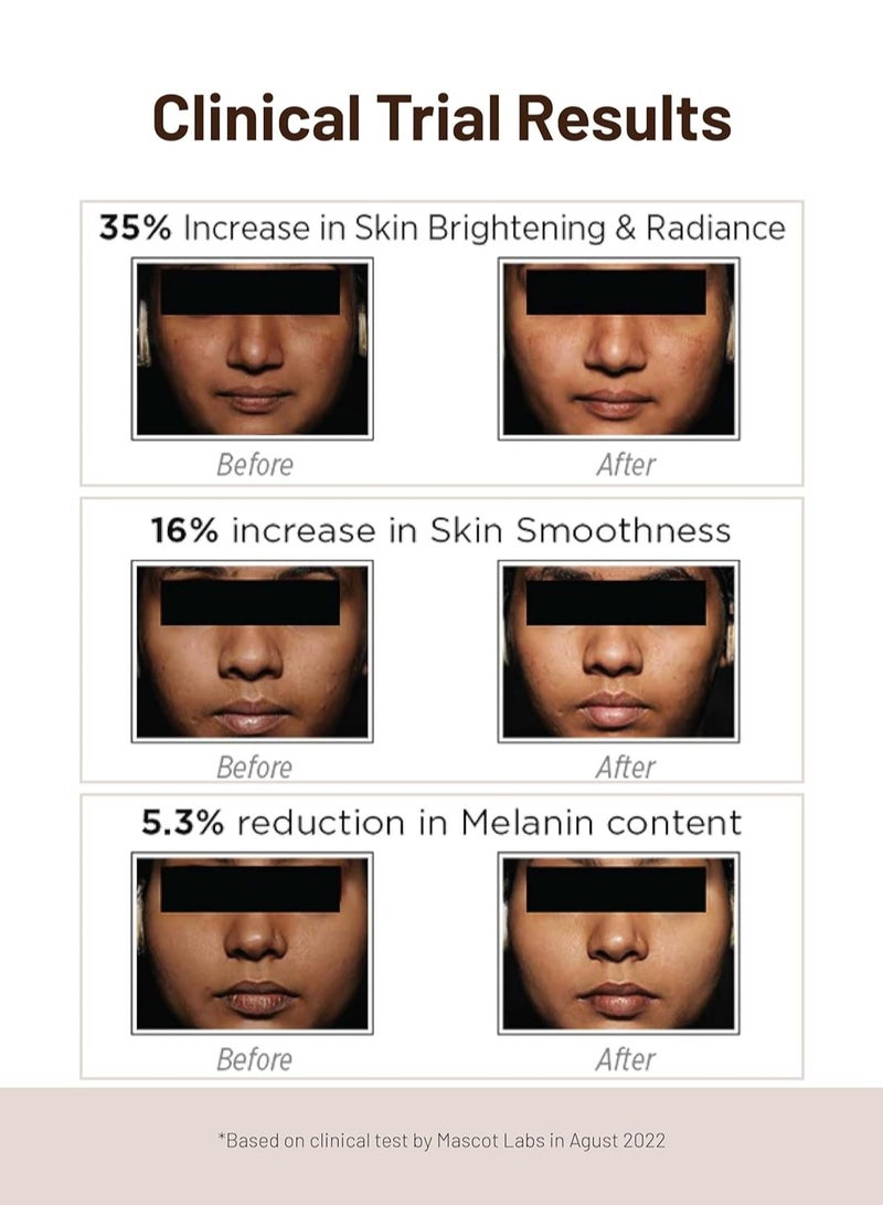 SkinQ Brightening Serum for Men and Women with Licorice and Lactic Acid 30ml Face Elixir for Tan Pigmentation and Dark Spots Exfoliates Brightens Softens and Repairs Sun Damaged Skin - Image 3