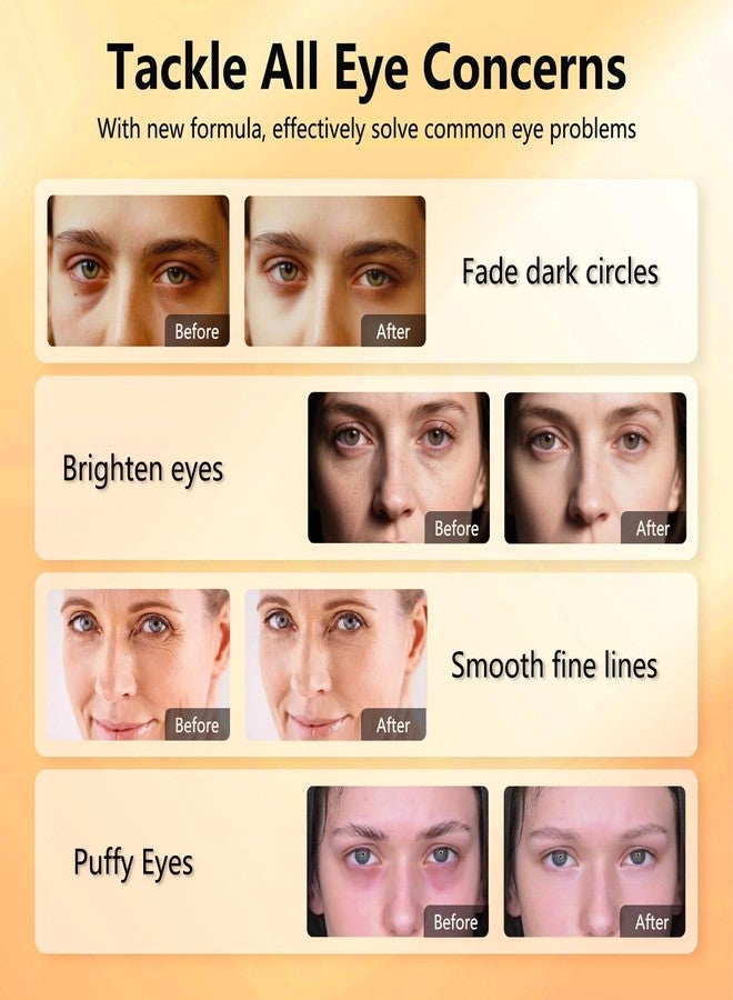 Aeryea Under Eye Patches with Vitamin C & Caffeine 30 Pairs for Dark Circles, Fine Lines and Puffiness, with Niacinamide Hydra-Gel Collagen, Skin Care for Men & Women - Image 5