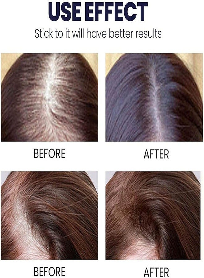 Generic 2 Pack Hair Growth Spray 2×50ml  - Image 4