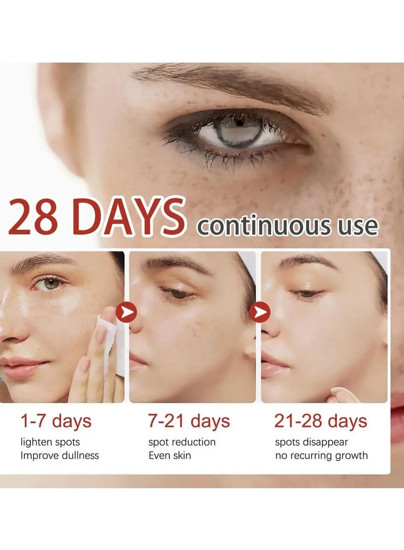 EELHOE 1 قطعة كريم تصحيح تصبغ الوجه الميلانين الكلف البقع الداكنة النمش إصلاح الجلد - Image 4