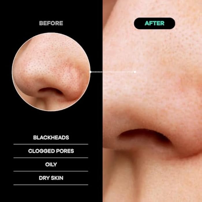 Dermasuri Deep Exfoliating Face Mitt - Scrubber, Dead and Dry Skin Remover for Men and Women - Exfoliator Gloves for Shower and Dry Use - ( 1 Pack) - Image 4