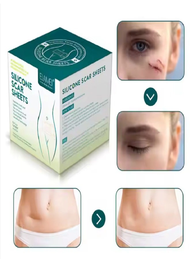 Elaimei Silicone Scar Sheets (1.6” x 60”Roll-3M), Silicone Scar Tape Roll, Scar Silicone Strips, Reusable, Professional Scar Removal Sheets for C-Section, Surgery, Burn, Keloid, Acne et - Image 1