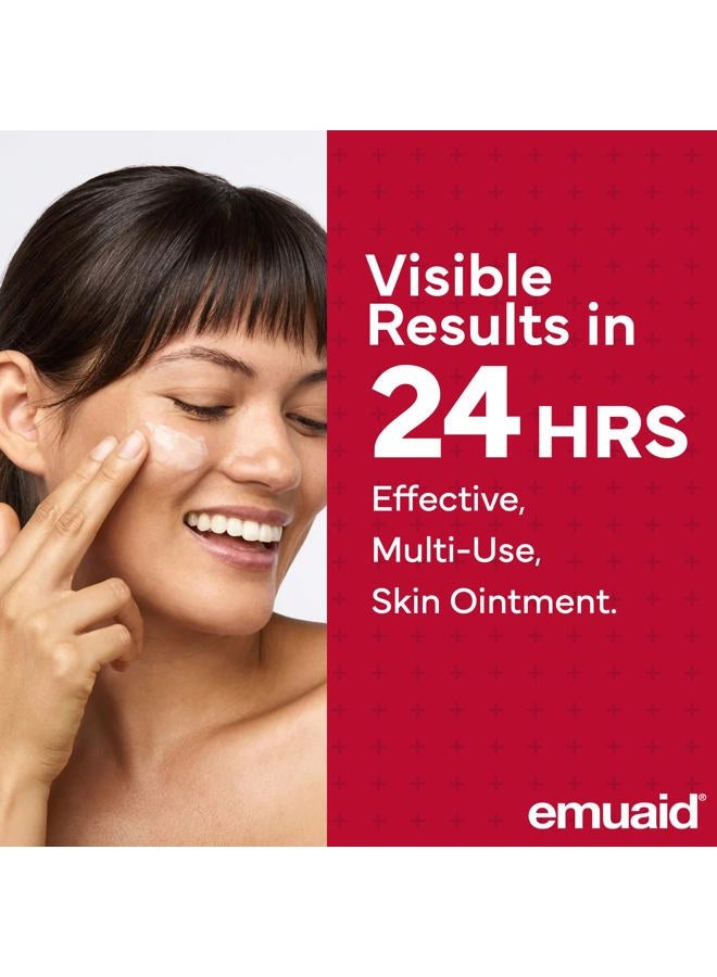 emuaid EMUAIDMAX Eczema Ointment, Maximum Strength Soothing Relief for Eczema, Psoriasis, Athlete's Foot, Jock Itch, Rashes, Itchy, Dry, Irritated Skin and Minor Skin Irritations, 16oz - Image 2