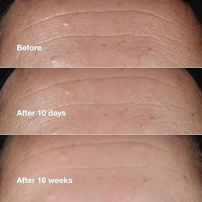 Clinique Smart Clinical Repair Wrinkle Correcting Anti Aging Face Serum With Hyaluronic Acid, Peptides + Advanced Retinoid Serum For All Skin Types | Hydrating - Image 4