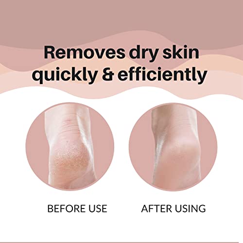 TRITON Professional Stainless Steel Lazer Foot Scraper, Filer for Hard and Dead Skin Callus Removal, Pedicure Foot Scrubber, Men and Women - Image 3