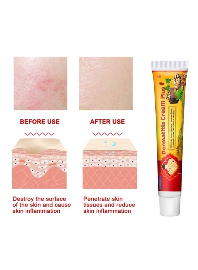 سوميفون كريم التهاب الجلد - 20 جرام - صيغة مضادة للبكتيريا ومضادة للحكة لتخفيف سريع - يهدئ ويعالج الإكزيما والصدفية - يخفف حكة الجلد وعدم الراحة - يرطب ويوفر التغذية للبشرة - Image 3