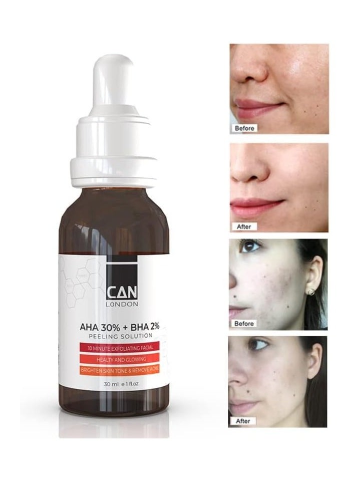 iCan London - AHA 30% + BHA 2% Serum - Healthy Exfoliating Brightening Facial Serum 30ml - Image 1