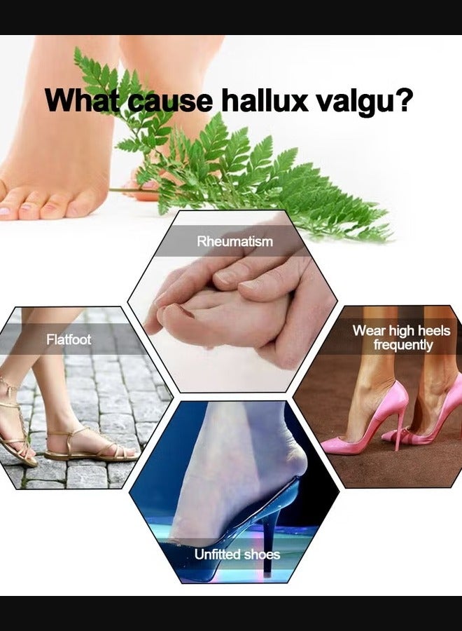 Thumb Straightener Bunion Stretchers Protector - Image 4