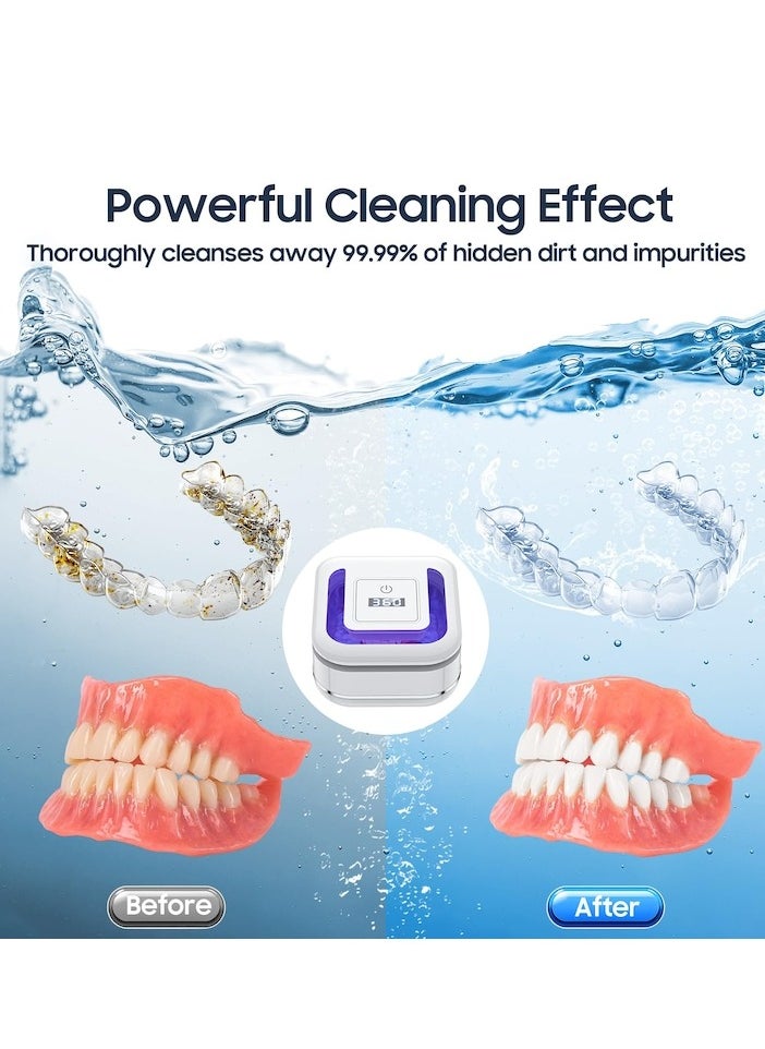 XiuWoo Ultrasonic Retainer Cleaner Machine for Denture, 42000Hz Portable Dental Guard Cleaner, white  - Image 5