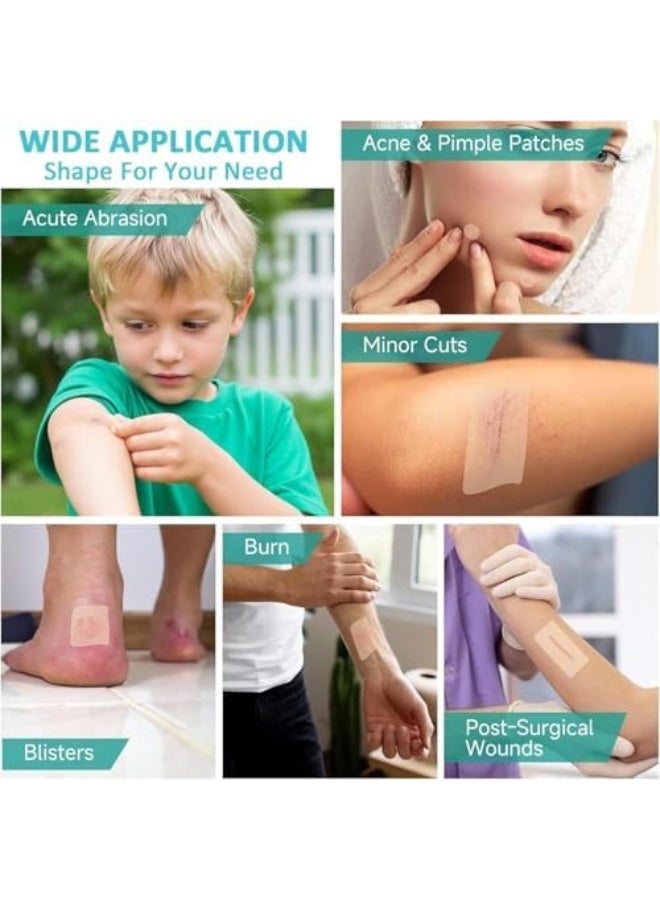 BCK لاصق هيدروكوليد، ضمادة للعناية بالجروح، شريط هيدروكوليد قابل للقطع حسب الحجم، لاصق محمول لطيف وقابل للتنفس، مناسب للبشرة الحساسة لليدين والقدمين والأصابع والوجه وحب الشباب (5 سم * 2 م) - Image 5