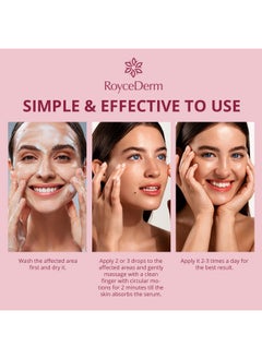 Roycederm Stye Eye Treatment Serum: Natural Stye Remover For Styes Chalazion And Blepharitis - Safe & Fast Relief  - Image 3
