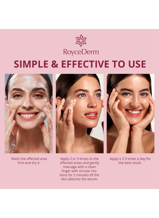 Roycederm Stye Eye Treatment Serum: Natural Stye Remover For Styes Chalazion And Blepharitis - Safe & Fast Relief - Image 3