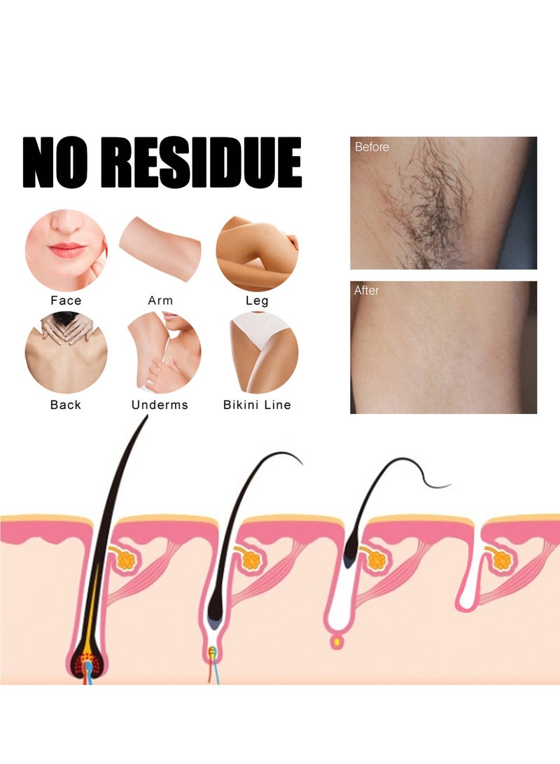 EELHOE Hair Removal Spray For Man, Painless Hair Removal Spray Armpit Gentle Hair Remover Refreshing Quick Hair Removal Spray, Natural Ingredient Hair Removal Spray For Man - Image 2