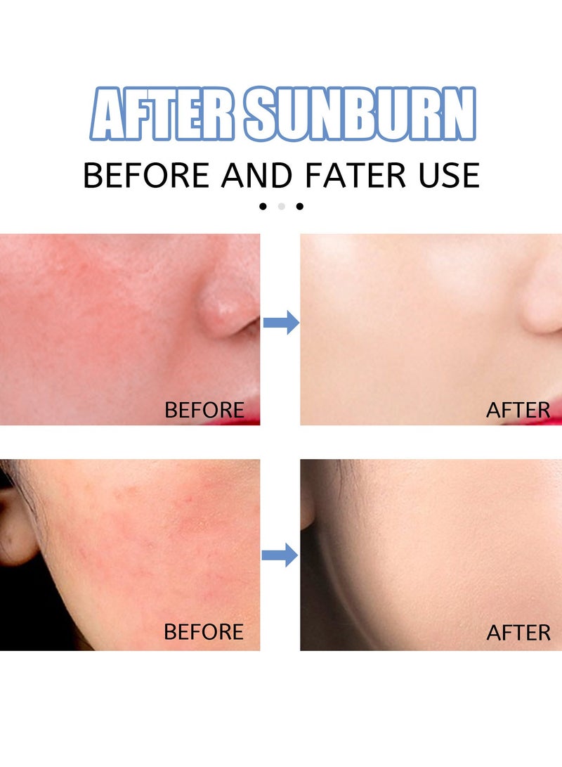 EELHOE After Sun Repair Cream, After Sun Moisturiser, Tanning Repair Moisturiser with Organic Aloe Vera and Hyaluronic Acid moisturises, soothes, cools and nourishes the skin after sunbathing, and provides anti-ageing benefits for dry and sensitive skin.  - Image 3