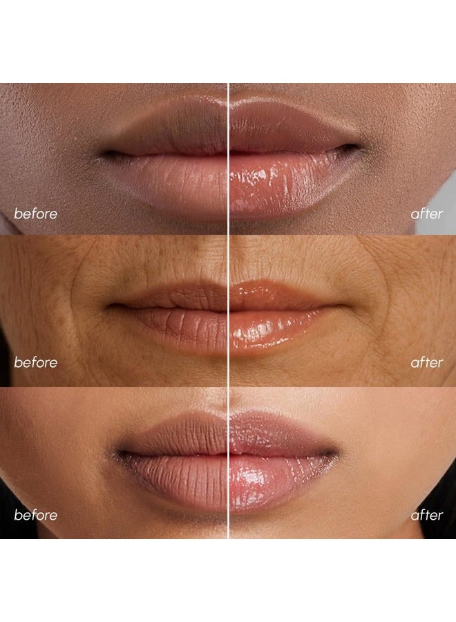 MAREE Lip Mask Overnight 2 Pack - Lip Moisturizer For Very Dry Lips - Hydrating Lip Butter Balm with Hyaluronic Acid & Collagen - Overnight Lip Treatment - Lip Sleeping Mask Repair - Image 5