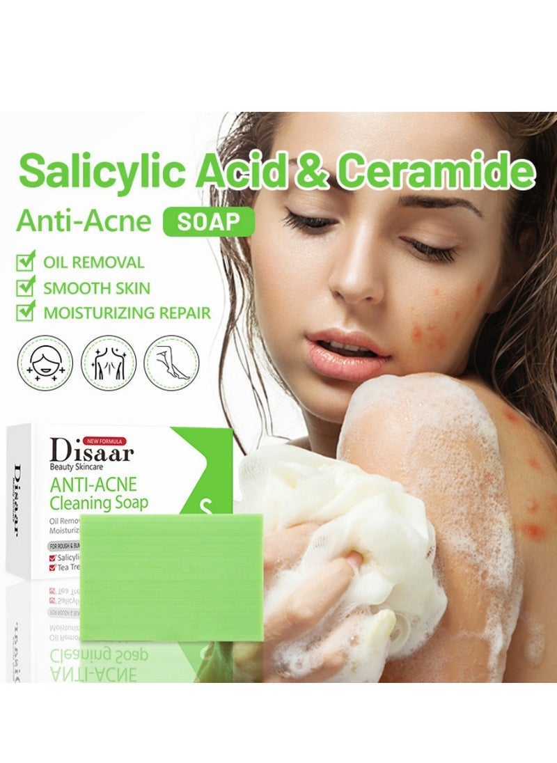 Disaar - Anti-Acne Soap, Salicylic Acid Scrub Soap, Back Acne Lighten, Softening Skin, Removing Acne, Exfoliating, Desalting Acne Mark Moisturizing Skin Cleansing Soap Shower Soap - Image 1