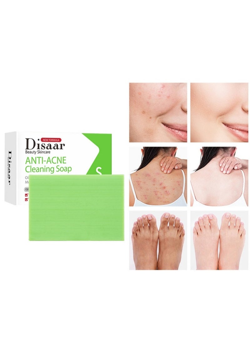 Disaar - Anti-Acne Soap, Salicylic Acid Scrub Soap, Back Acne Lighten, Softening Skin, Removing Acne, Exfoliating, Desalting Acne Mark Moisturizing Skin Cleansing Soap Shower Soap - Image 1
