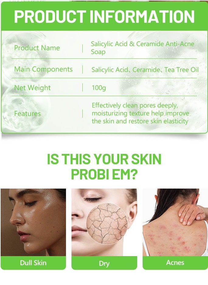 Disaar - Anti-Acne Soap, Salicylic Acid Scrub Soap, Back Acne Lighten, Softening Skin, Removing Acne, Exfoliating, Desalting Acne Mark Moisturizing Skin Cleansing Soap Shower Soap - Image 1