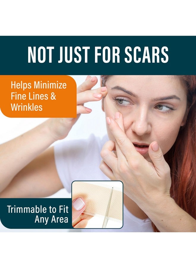 نوفاديرميس شرائح سيليكون لعلاج الندبات من نوفاديرميس - شرائح طبية طويلة جدًا لعلاج الندبات لعمليات الولادة القيصرية، وشد البطن، والجُدْرَة، والندبات الجراحية - قابلة لإعادة الاستخدام وفعالة - عبوة من 4 قطع - لون متوسط - Image 1