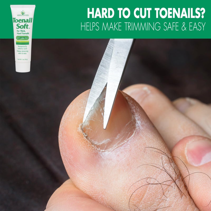 Miracle of Aloe Toenail Softener for Thick Hard Toenails - Safe for Seniors & All Ages - Fast-Acting Toenail Softening Cream - Ingrown Toenail Treatment - Non Greasy Nail Cream Formulated with Natural Aloe Vera, 1 oz - Image 2