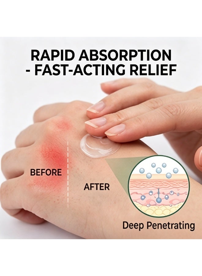 Culurfu Professional Bedsore Repair Cream 20g - Fast Penetrating Herbal Formula for Pressure Sores & Skin Ulcers - Deep Tissue Healing & Soothing Care for Bedridden Patients - Image 2
