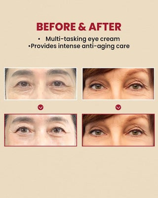 K-SECRET SEOUL 1988 Eye Cream : Retinal Liposome 4% + Fermented Bean - view 3