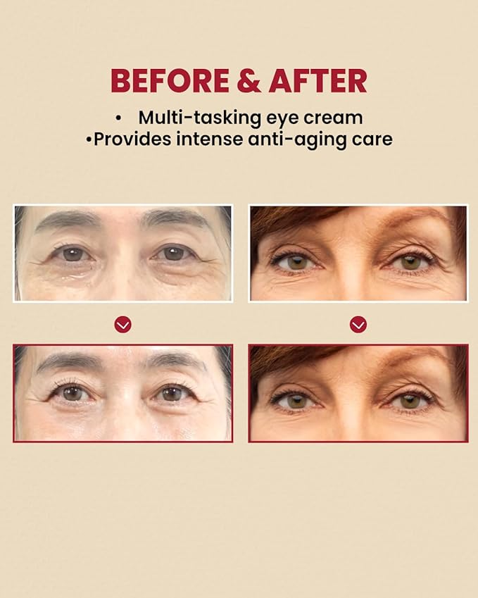 K-SECRET SEOUL 1988 Eye Cream : Retinal Liposome 4% + Fermented Bean - Image 3